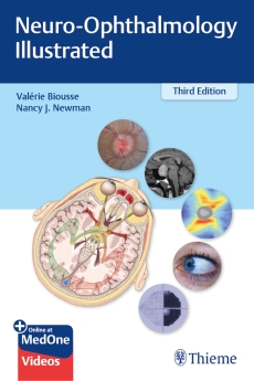 Neuro-Ophthalmology Illustrated - 3rd Edition 2020