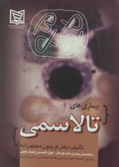 بیماری های تالاسمی