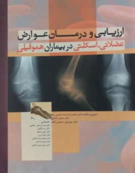 ارزیابی و درمان عوارض عضلانی_اسکلتی در بیماران هموفیلی