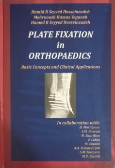 Plate fixation in orthopaedics: basic concepts and clinical applications