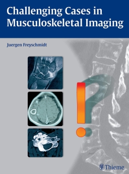 کتاب Challenging Cases in Musculoskeletal Imaging