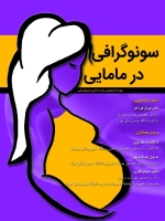 سونوگرافی در مامایی