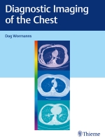 کتاب Diagnostic Imaging of the Chest 2020