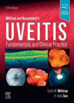 کتاب Uveitis Fundamentals and Clinical Practice 5th