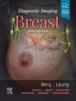 کتاب Diagnostic Imaging: Breast 3rd Edition