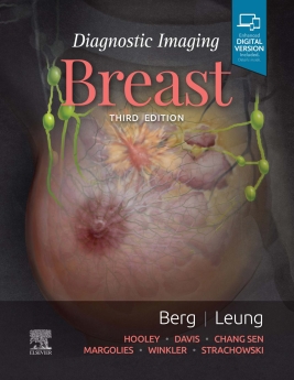 کتاب Diagnostic Imaging: Breast 3rd Edition