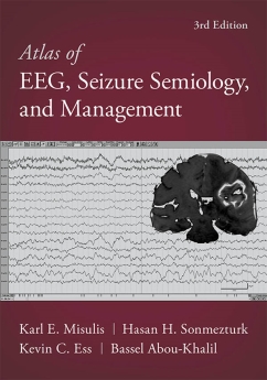کتاب Atlas of EEG, Seizure Semiology, and Management