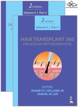 Hair Transplant 360: Follicular Unit Excision