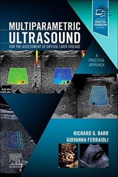Multiparametric Ultrasound for the Assessment of Diffuse Liver Disease : A Practical Approach 2023