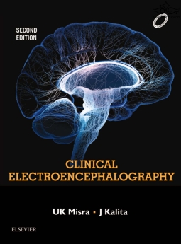 Clinical Electroencephalography