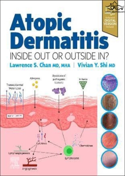 Atopic Dermatitis: Inside Out or Outside In