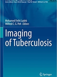 Imaging of Tuberculosis