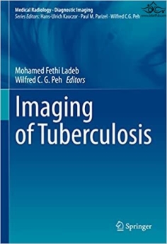 Imaging of Tuberculosis