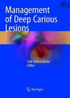 Management of Deep Carious Lesions 2018