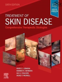 Treatment of Skin Disease : Comprehensive Therapeutic Strategies