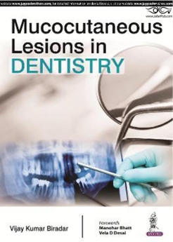 Mucocutaneous Lesions in Dentistry