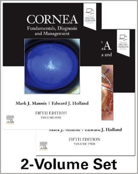 Cornea