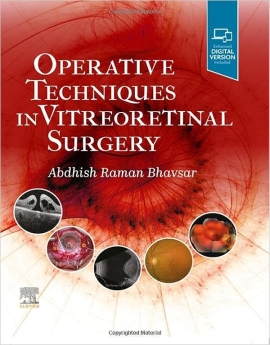 Operative Techniques in Vitreoretinal Surgery