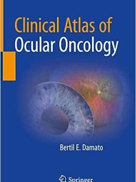 Clinical Atlas of Ocular Oncology