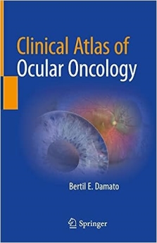 Clinical Atlas of Ocular Oncology