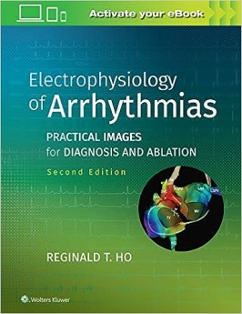 Electrophysiology of Arrhythmias: Practical Images for Diagnosis and Ablation 2nd Edicion 2020