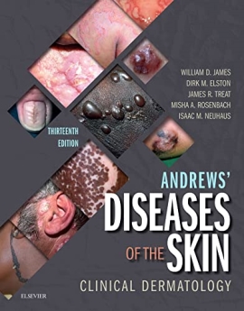 Andrews' Diseases of the Skin : Clinical Dermatology