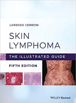 Skin Lymphoma: The Illustrated Guide 2020
