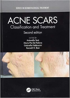 Acne Scars: Classification and Treatment, 2nd Edition