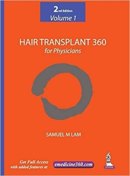 Hair Transplant 360 for Physicians 2nd Edition2019