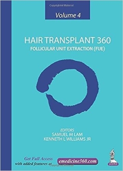 Hair Transplant 360: Follicular Unit Extraction