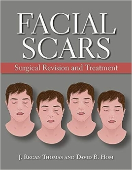 Facial Scars: Surgical Revision and Treatment