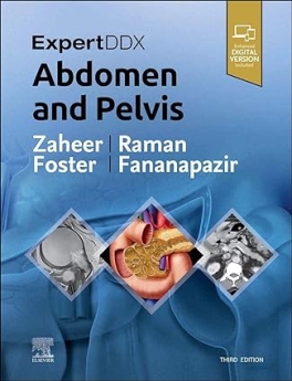 ExpertDDx: Abdomen and Pelvis, 3rd Edition 2023