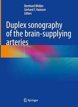 Duplex sonography of the brain-supplying arteries Kindle Edition