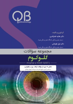 مجموعه سؤالات گلوکوم (QBO)