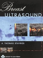 Breast Ultrasound 1st Edition