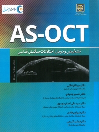 AS-OCT     تشخیص و درمان اختلالات سگمان قدامی