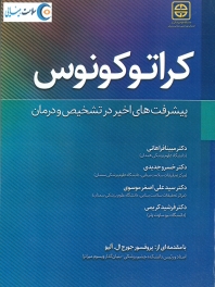 کراتوکونوس