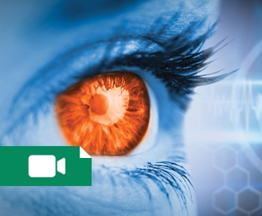 کلاس چشم پزشکی، OSCE سال 1396 (Ophthalmology)