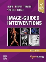 Image-Guided Interventions: Expert Radiology Series 3rd Edition