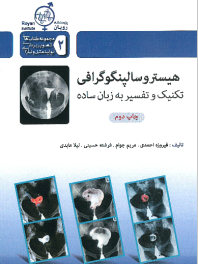 هیستروسالپنگوگرافی تکنیک و تفسیر به زبان ساده