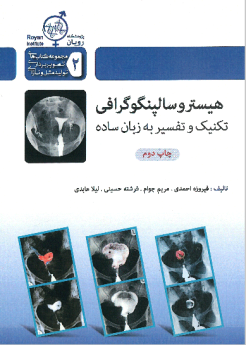 هیستروسالپنگوگرافی تکنیک و تفسیر به زبان ساده