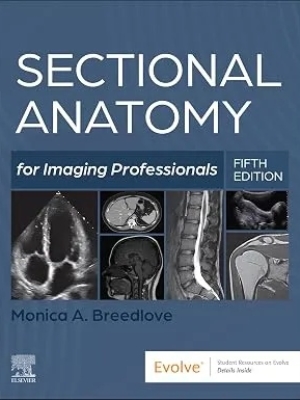 Sectional Anatomy for Imaging Professionals – 5th Edition | 2025