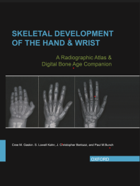 Skeletal Development of the Hand and Wrist