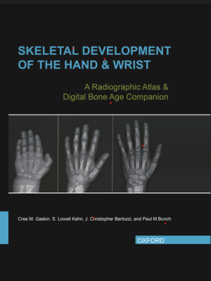 Skeletal Development of the Hand and Wrist