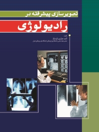 تصویر سازی پیشرفته در رادیولوژی