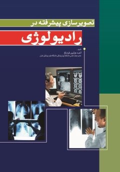 تصویر سازی پیشرفته در رادیولوژی