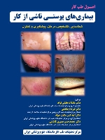 اصول طب کار ، بیماری‌های پوستی ناشی از کار ، شناسایی، تشخیص، درمان، پیشگیری و کنترل